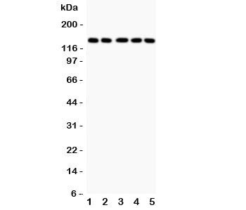 Western blot testing of Collagen 2 antibody and human samples 1: COLO320; 2: HeLa; 3: MCF-7; 4: A549; 5: Jurkat lysate. Predicted molecular weight ~140 kDa.