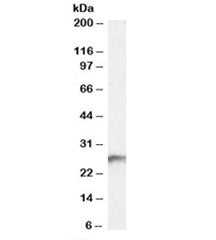 BDH2 Antibody
