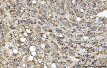 SEPT9 Antibody / Septin 9