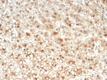 IHC staining of FFPE human kidney tissue with IL-18 antibody (clone IL18/4624) at 2ug/ml. HIER: boil
