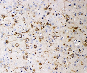 IHC-P: Neurofilament 200 antibody testing of rat brain tissue. HIER: steamed with pH6 citrate buffer