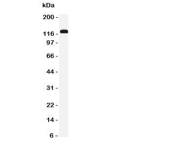 NKCC2 Antibody (SLC12A1)