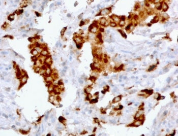 Napsin A Antibody