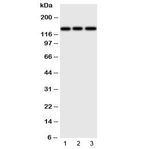 Western blot testing of ERBB4 antibody and Lane 1: human HeLa; 2: (h) U87; 3: mouse Neuro-2a cell ly