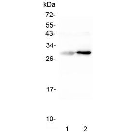 Serum Amyloid P Antibody