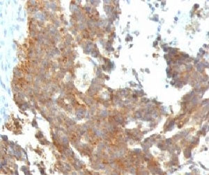 GnRH Receptor Antibody / GNRHR