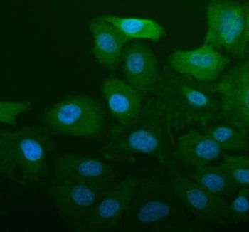 Immunofluorescent staining of FFPE human A549 cells with ALDH1A1 antibody (blue) and DAPI nuclear st