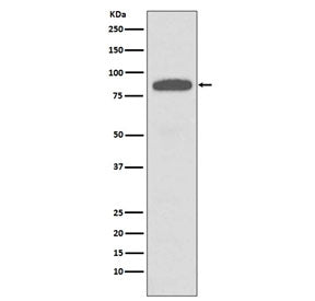Western blot testing of human A431 cell lysate with IKK alpha/beta antibody. Predicted molecular wei