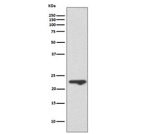 Western blot testing of human T-47D cell lysate with Mucin-1 antibody. Expected molecular weight: 17