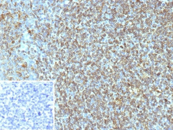 IHC staining of FFPE human tonsil tissue with CD74 antibody (clone CLIP/7947). Inset: PBS used in pl