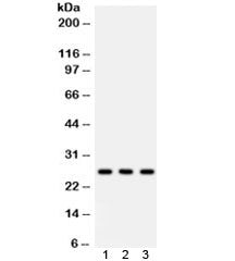 SFTPA1/2 Antibody