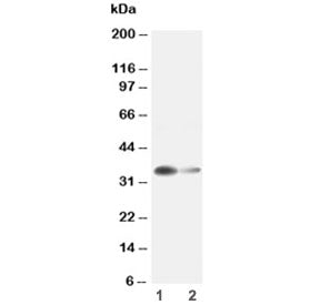 Western blot testing of Arginase 1 antibody and Lane 1: rat liver ; 2: rat kidney lysate. Predicted 