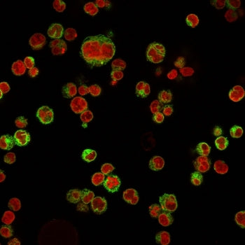 CD74 / CLIP Antibody