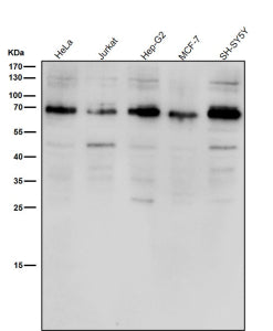 Western blot testing of human samples using the ACBD3 antibody at 1:1000 dilution for 1 hour at room temperature. A single major band is detected just below the 70 kDa marker, consistent with the expected migration of full-length ACBD3, which typically runs above its predicted 61 kDa mass due to phosphorylation and the structured coiled-coil/GOLD domains that alter SDSâ€“PAGE mobility. The observed band therefore represents the mature, Golgi-associated form of ACBD3.