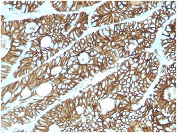 IHC staining of FFPE human colon with Cadherin 17 antibody (clone CDH17/2615). HIER: boil tissue sec