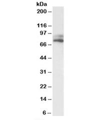 Western blot testing of human HepG2 lysate with VPS16 antibody at 1ug/ml. Predicted molecular weight