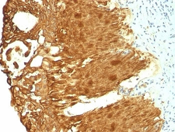 KRT19 Antibody Cocktail / Cytokeratin 19