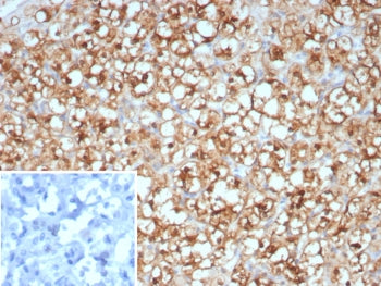 STMN1 Antibody / Stathmin 1