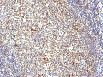 IHC analysis of formalin-fixed, paraffin-embedded human tonsil stained with NuMA antibody (clone SPM