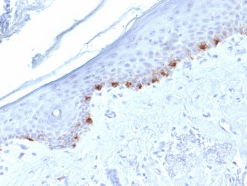 IHC testing of FFPE human skin with TYRP1 antibody (clone TYRP1/1986). HIER: boil tissue sections in