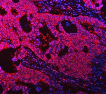 TMS1 Antibody / PYCARD / hASC