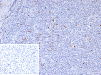 IHC staining of FFPE human tonsil tissue with Scurfin antibody (clone FOXP3/8145R). Inset: PBS used 