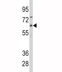 CYP1B1 Antibody