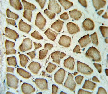 IHC testing of FFPE human skeletal muscle tissue with FGG antibody. HIER: steam section in pH6 citra