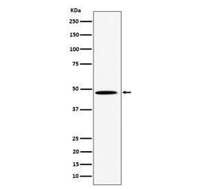 Western blot testing of human HeLa cell lysate with P4HTM antibody. Predicted molecular weight: 47-6