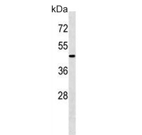 Western blot testing of mouse kidney tissue lysate with ATG4A antibody. Predicted molecular weight ~