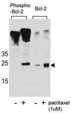 Western blot analysis of extracts from Jurkat cells, untreated or treated with Paclitaxel, using pho
