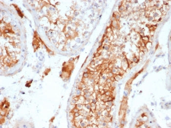 IHC staining of FFPE human testis tissue with recombinant INHA antibody (clone INHA/6598R). HIER: bo