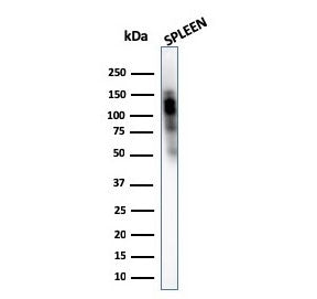 Western blot testing of human spleen lysate with CD11b antibody (clone ITGAM/3340). Expected molecul