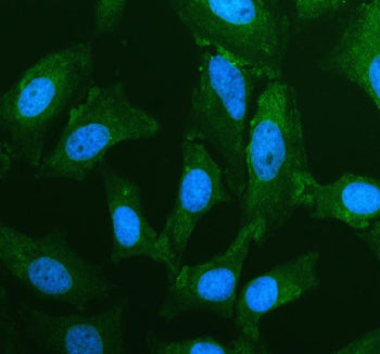 PDE8B Antibody / Phosphodiesterase 8B, 100ug