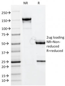 CELA3B Antibody / Elastase 3B
