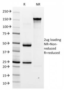 Helicobacter pylori Antibody