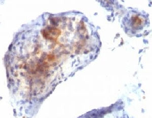 FOXP3 Antibody / Scurfin
