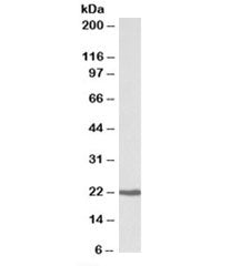 Western blot testing of human Daudi lysate with CBFB antibody at 0.3ug/ml. Predicted molecular weigh