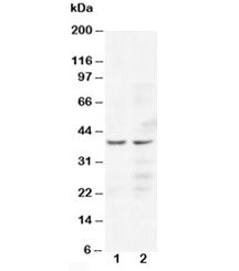 Western blot testing of CCR5 antibody and human Lane 1: Jurkat; 2: COLO320 cell lysate. Predicted/ob