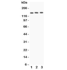Western blot testing of Angiotensin Converting Enzyme antibody and Lane 1: A549; 2: HeLa; 3: 22RV1 l