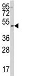 SSB Antibody
