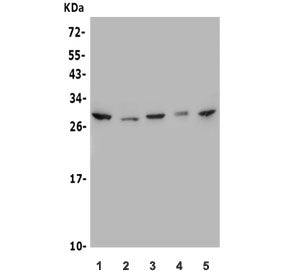 Western blot testing of human 1) A549, 2) HeLa, 3) HEK293, 4) Caco-2 and 5) Raji lysate with MESP1 a
