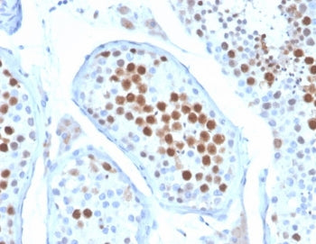 KIF2C Antibody / MCAK