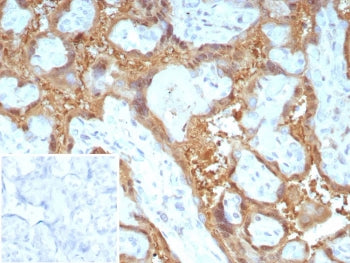 LGALS13 Antibody / Galectin 13