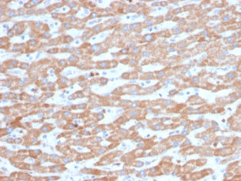 SDHB Antibody / Succinate dehydrogenase B