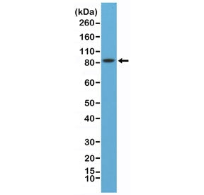 Western blot testing of mouse brain lysate with recombinant PSD95 antibody at 1:8000 dilution. Predi