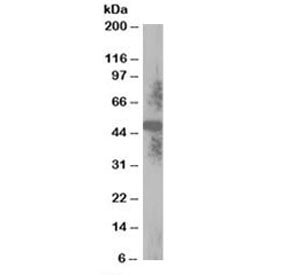 TXNDC5 Antibody