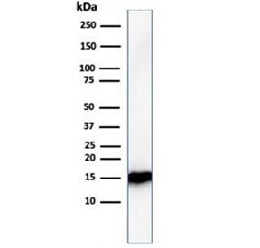 FABP1 Antibody