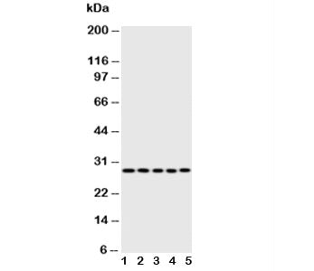 Western blot testing of Caspase-14 antibody; Lane 1: rat brain; 2: rat liver; 3: rat spleen; 4: huma