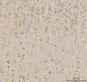 IHC staining of FFPE rat brain tissue with NPTXR antibody. HIER: boil tissue sections in pH8 EDTA fo